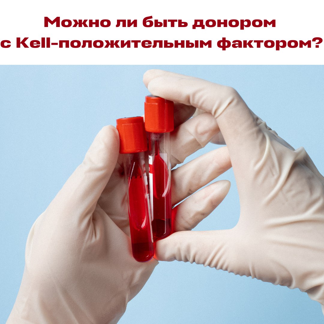 Можно ли быть донором, если у вас Kell-положительный фактор?